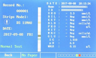 Urine Analyzer Pathological Analysis Equipment